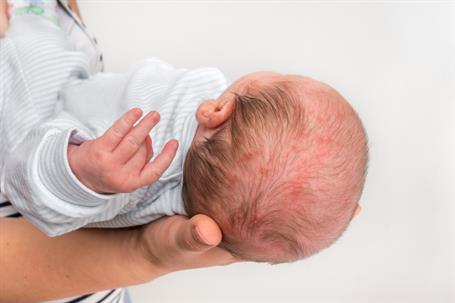 Birth Injury Claim
